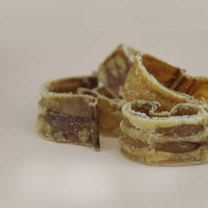 Aritos de Tráquea
